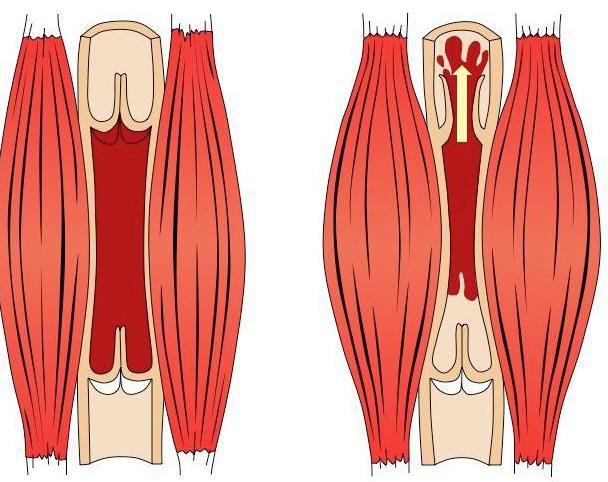 венозные клапаны нижних конечностей человека 